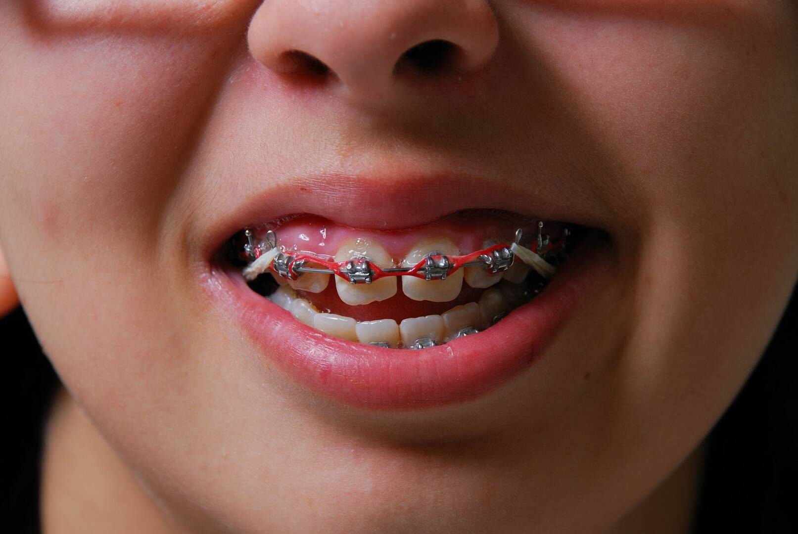 Blome Family Dentistry